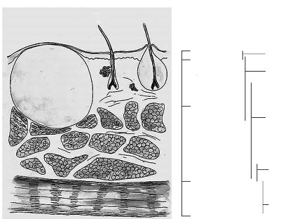 Jästsvamp 4,3 Anaeroba 3,6 Acinetobacter 0,4 Pseudomonas 2,4 Pasteurella 0,6 Proteus 1,9 Enterobacter 2 Klebsiella 1,8 Övriga 3,9 E. coli 4,4 S. aureus 46 Corynebact.