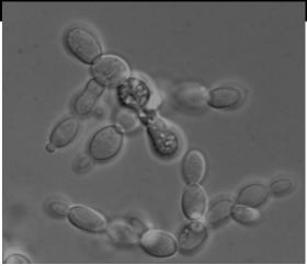 industriell bioteknik, 13 Kurs i immunologi