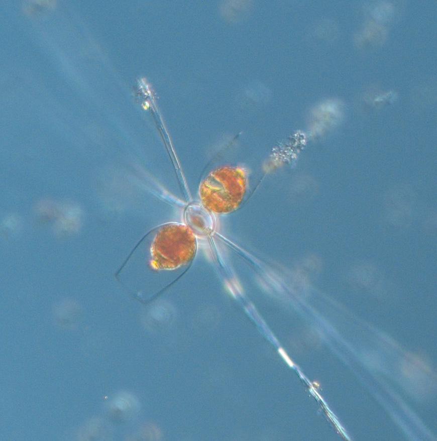 One cell of the diatom Chaetoceros impressus surrounded by two