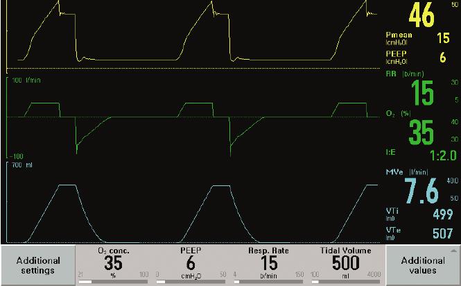 Beskrivning ventilatortestning Komplexa realtidssystem mjukvara & mekatronik Mätning av flöde och tryck är vitalt Ca 50% av testfallen återanvänds vid nya produktreleaser Gamla testfall hittar få nya