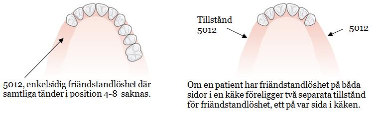 Det är tillstånd 5010, enkelsidig friändstandlöshet där samtliga tänder i position 6-8 saknas.