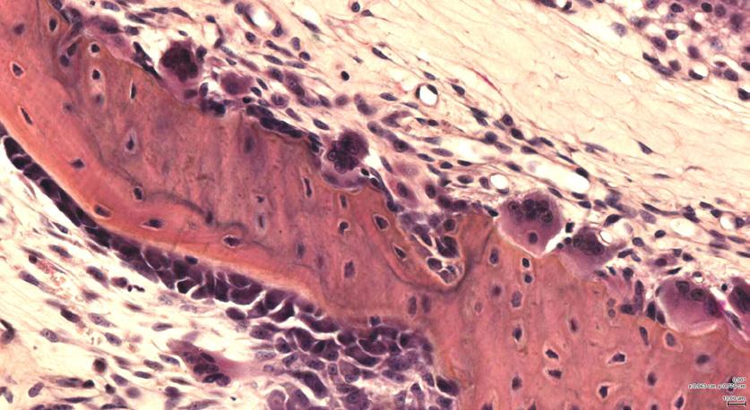 Inuti benet finns en stor mängd osteocyter som tidigare varit osteoblaster men som nu bakats in i benvävnaden. Bilden har ställts till förfogande av professor Tim Arnett, University College, London.