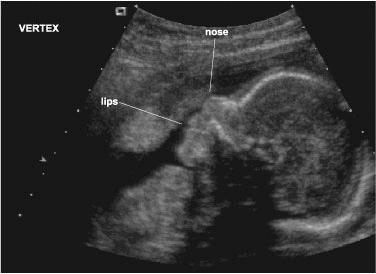 Olika ultraljudsystem B-mode: en två dimensionell presentation av ljudvågsekon som uppstår i gränsytor i ett