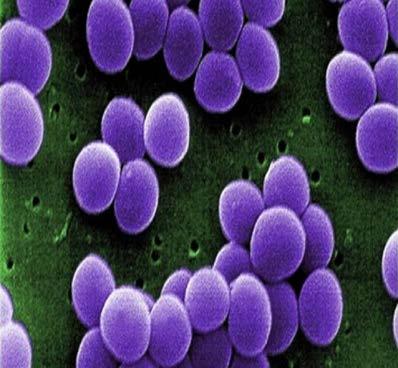 Stafylococcus aureus gula stafylokocker En av våra vanligaste omgivningsbakterier Bärarskap