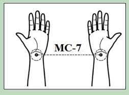 Behandling via 2 universella punkter, MC7 Man lägger 2 elektroder på dessa 2 punkter på handlederna.