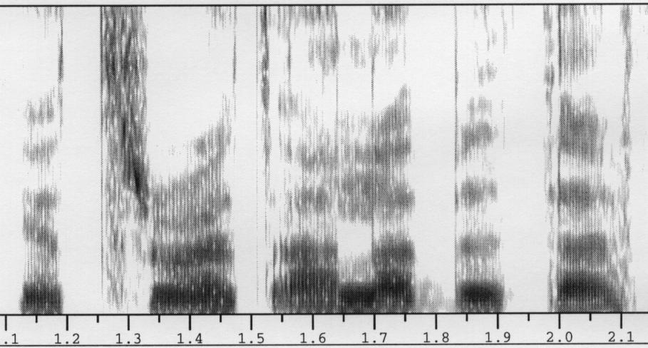 Talteknologi 25-2-3 [ 4 ] Inverkan av mikrofonavstånd Samma yttrande inspelat med 2 mikrofoner i tyst kontorsrum Det generella problemet är olöst Åtgärder i praktiska system Headsetmikrofon 2 m