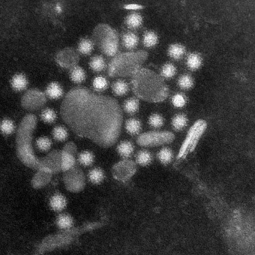 Miljö Norovirus Alla Mest vinter. Sjukhus, särskilda boenden.