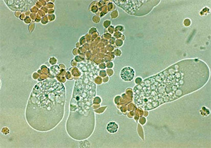 Parasiter och protozoer Särdrag klinik Antibiotika Giardia lamblia 1-2 v Subakut sekretorisk diarré, gaser, viktnedgång Ja Inkubationstid