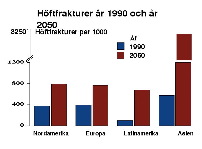 Höftfrakturer 1990-2050 Magnus