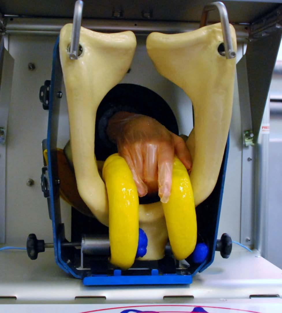 Figur 2. Palpation av en icke-dräktig livmoder med äggstockar sett från buksidan.