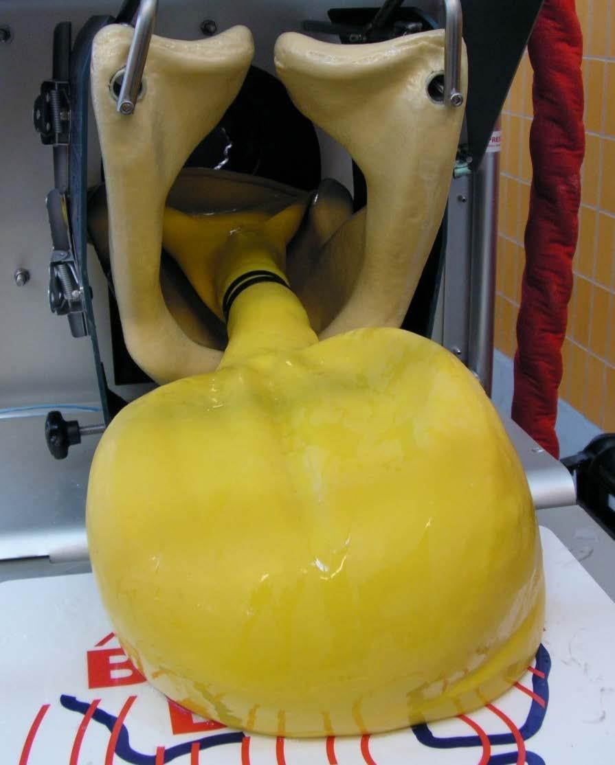 Figur 16. Livmodermodell som ska motsvara 11 veckors dräktighet. Foto: Johanna Schaub Enligt Noakes et al.