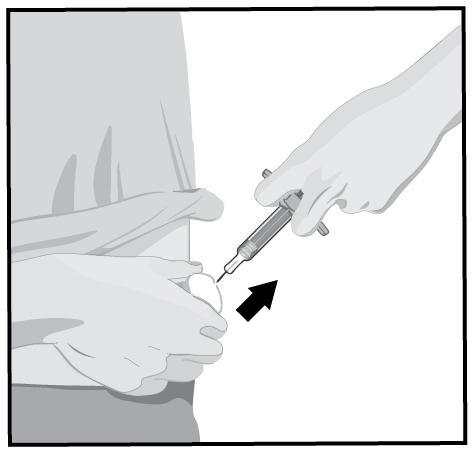 STEG 8 När injektionen är klar, dra långsamt bort nålen ur huden och håll den förfyllda sprutan i samma vinkel som när den stacks in.