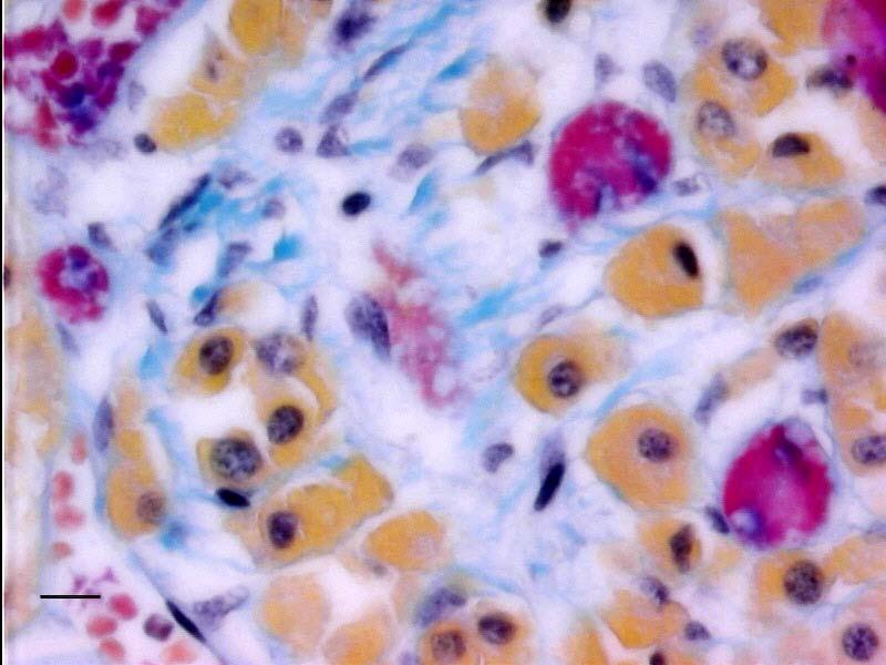 urskiljas. Celler med färglösa hålrum (Bb) i cytoplasman kan ses. Skalstreck: 14 µm. Fig.