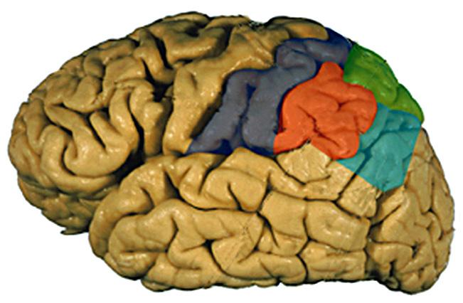 Multimodal interaktion och transformation Lobus parietalis superior Sulcus intraparietalis Spatiala symtom vid skada: Visuospatial desorientering Optisk ataxi/miss reaching Nedsatt