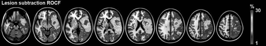 133 patients with a single focal lesion in one hemisphere tested > 3 months post lesion (Tranel, Rudrauf, Vianna, & Damasio, 2008) fmri studies have demonstrated bilateral frontoparietal activation