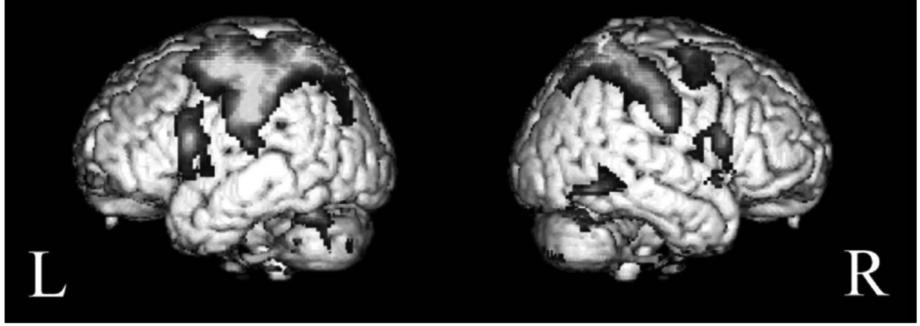 Both parietal lobes are involved in drawing: a functional MRI study Makuuchi, M. et al.