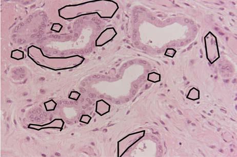 Dow gjorde en intressant observation i sin artikel från 1959: Low cuboidal epithelium is seen in many cysts, [ ], even during the early met-oestrus phase when secretion is normally at its height.