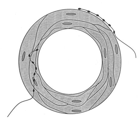 Kontrollen av blodkärlens tonus Muskeltonus = bestående kontraktion Blodkärlens diameter regleras av kärlmuskeln Vaskulär glatt muskel dilatation = hämning av myogen tonus lokalt reducerat tryck ökat