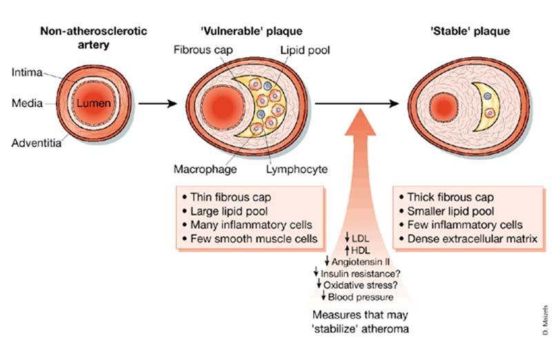 Cholesterol and lipid lowering