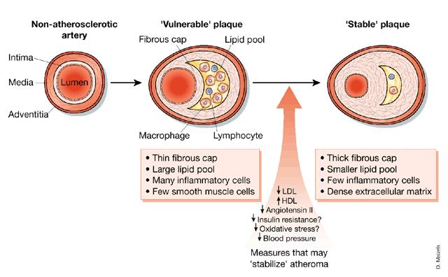Cholesterol and lipid lowering