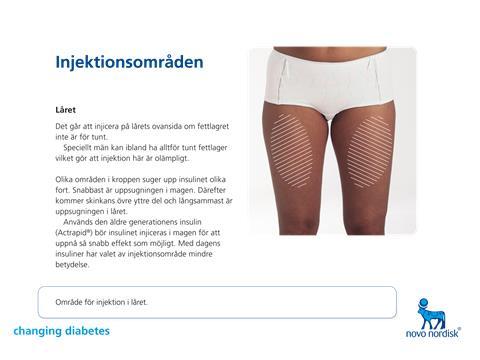 Använd alltid 4-6 mm kanyler På ordinationsunderlaget för insulin står det på vilket område på kroppen som insulinet ska ges Områden som kan vara ordinerade är mage, skinkans övre yttre del och