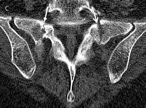 se/sidor/ imago-medica). MRT-översikt av ländryggen bestod av två sekven»ryggröntgen är därför av naturliga skäl sannolikt en utdöende konstart.