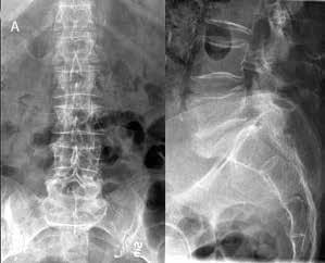 Det är därför inte att förvänta att dagens yngre radiologer ska besitta samma analysfärdighet av röntgenundersökningar av ryggraden som äldre radiologer.