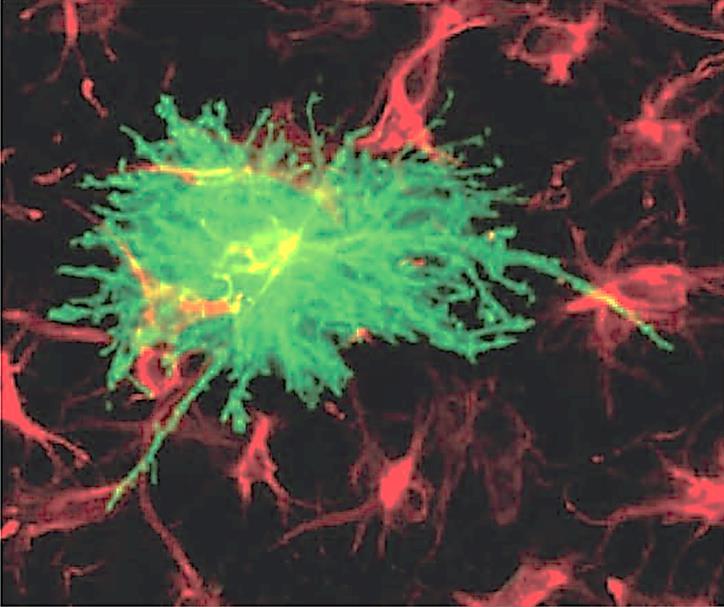 Ytterligare basala senare fynd i den normala mikroanatomin öppnar för tänkbara förklaringar till olika funktioner och ännu föga beaktade sjukdomsmekanismer Astrocyterna