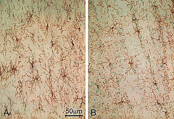 En ny variant av gliacell, NG2 oligodendrocyter, ungefär 5% 8% av alla celler i nervsystemet, femte gliacellen, uttrycker chondroitin sulfat proteoglycan (NG2) liksom många andra icke neuronala