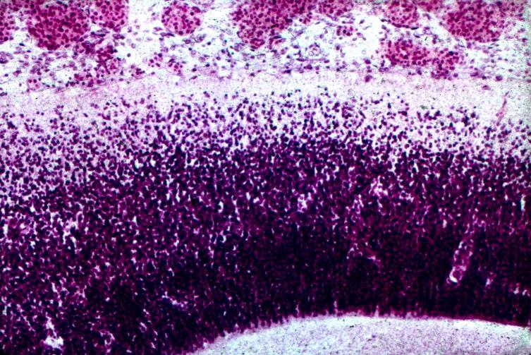 med dendrit- och neuritbildning 3 5 Vit substans 9 Hjärnblåsans vägg i 7e fosterveckan, med tidig radial migration av