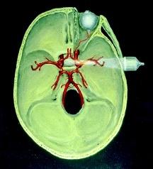 Johan Bellner, doktorand, avdelningsläkare, neurokirurgiska kliniken (johan.bellner@neurokir.lu.