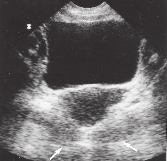 Kaudalt om bäckenets linea arcuata klär musculus obturatorius internus bäckenväggen (Fig 44). Bäckenbotten utgörs av musculus levator ani samt musklerna runt vagina och urethra.