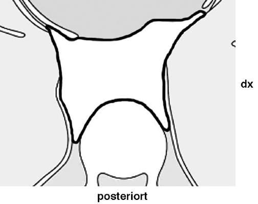 BILD: Bilden nedan visar en schematisk skiss av delar av ett horisontalsnitt genom thorax och mediastinum posterius, vars avgränsning är markerad med en kraftigare linje.
