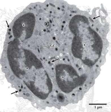 2018-04-19 15 Antineutrofila cytoplasmatiska antikroppar (ANCA) Känsliga markörer för pauciimmun små kärlsvaskulit Del i patogenes