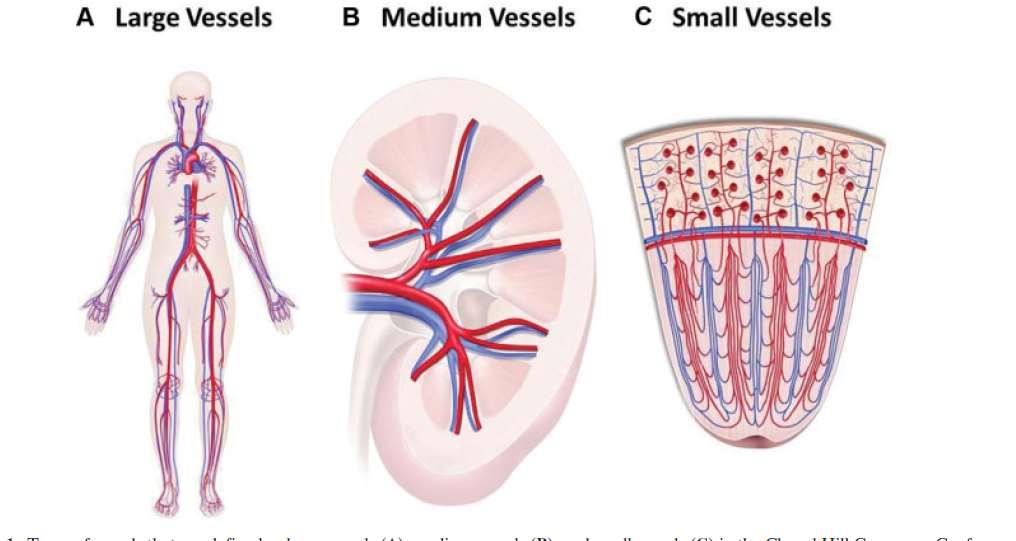 Klassifikation av primära vaskulitsjukdomar