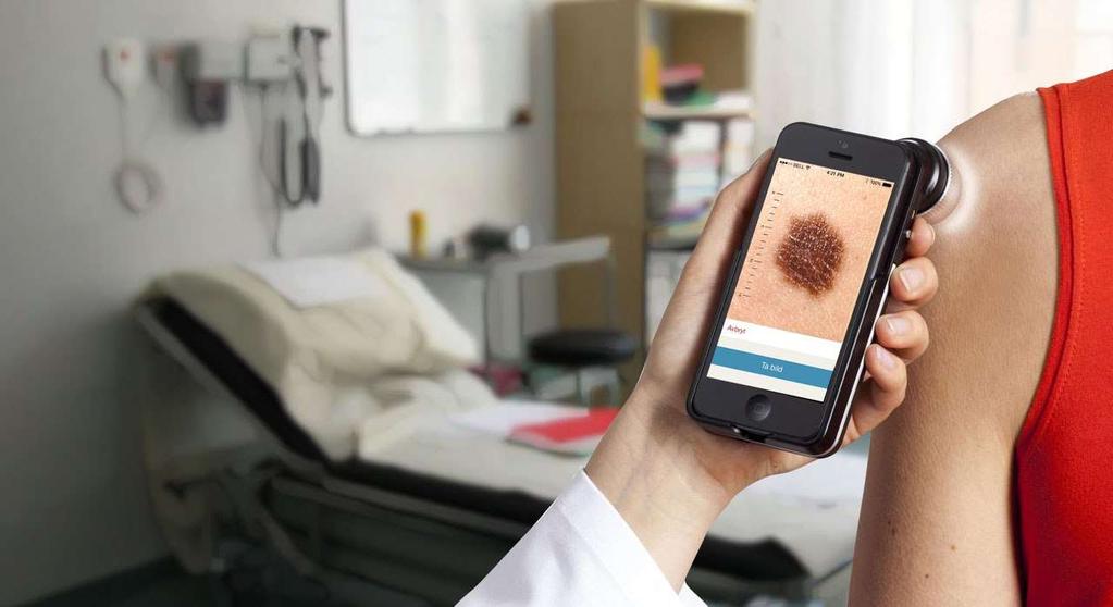 Lösningen: Teledermatoskopi Bild tas direkt på vårdcentral och bifogas
