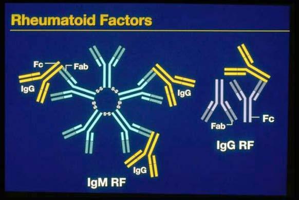Autoantikroppar vid RA 1. Reumatoid faktor (RF) Antikroppar mot Fc-delen av IgG.