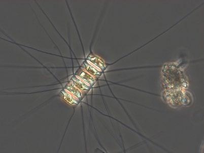 I mitten till höger dinoflagellaten Ceratium tripos, nederst till vänster den potentiellt