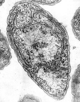 Proteobacteria: Nitrosomonas