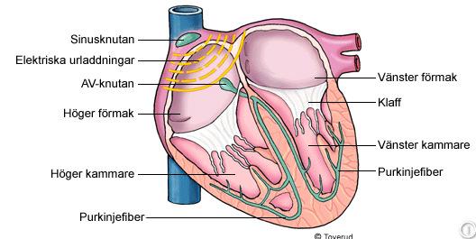 Structural Cardio- Pulmonary Non-syncopal 1 Vasovagal Carotid Sinus Situational