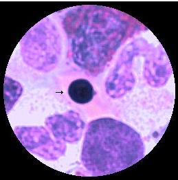 förväxlas lätt med lymfocyt som är mer basofil med mindre