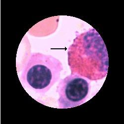 Hemocytoblast Myeloblast Promyelocyt ojämn kontur, oval K:, lucker, röd,