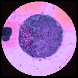 Hemocytoblast Myeloblast Promyelocyt ojämn kontur, oval K:, lucker, röd, oval, svagt perifer C: basofil-> ofärgad, azurofila granula