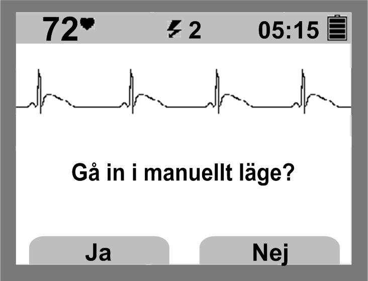 Reglage och indikatorer Defibrilleringindikator Indikator för hjärtfrekvens Meddelandefält Symbol för batteristatus Förfluten tid EKG Meddelanden Text på programknappen Menyknapp Programknappar Figur