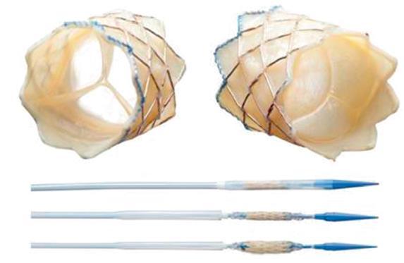 Klafförsett stent - Melody Täckt stent med bovin klaff Stor införare => 22F = 7,3 mm - Barn > 25 (20) kg Storlek 16-22 mm - Ej urvuxna conduit Kräver förstentning Kan