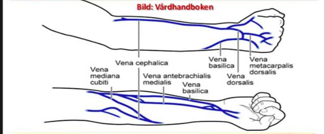 2014%04%21 Ytligaveneriarmen Ytligavenerärtunnareochharmindrevolymändjupavener. Blodprov,venpunk.on,tasoFaimedianacubuli.OBSaTabrachialisochnbrachialis gårnäraunder! Enterohepa.skacirkula.