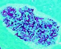 !debatt och brev Foto: ljunganvirus.se»ljunganvirus replikerar i många olika celltyper, men virusmängderna är låga och viruset verkar ha dålig effektivitet.