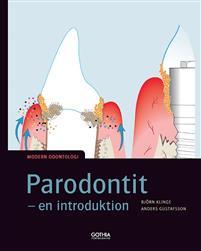 Parodontit : en introduktion PDF ladda ner LADDA NER LÄSA Beskrivning Författare: Björn Klinge. I denna sjätte upplaga av Parodontit har texten uppdaterats och utökats.