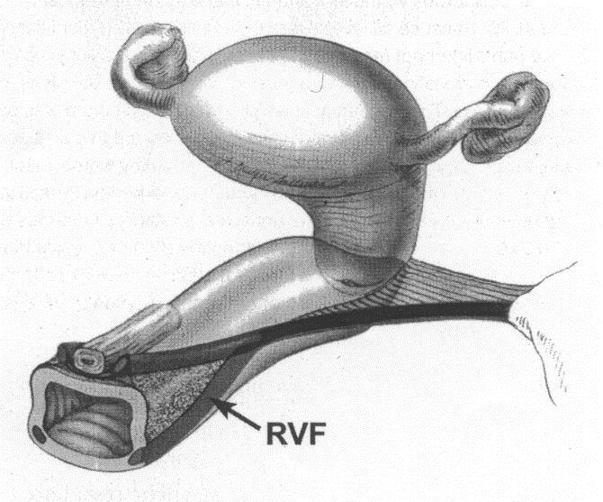 Rektovaginala fascian