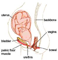 Ansträngningsinkontinens 1914 Kelly There is a type of urinary incontinence in women, without manifest injury